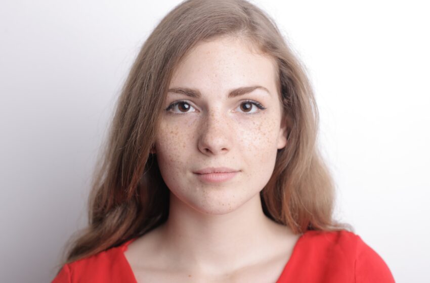 Acne Code Unveiling: Decoding Genetic Factors Affecting Acne