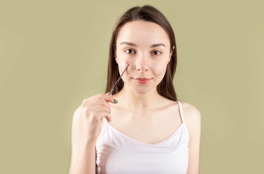 Clear Skin, Clear Planet: Environmental Triggers for Acne and Solutions