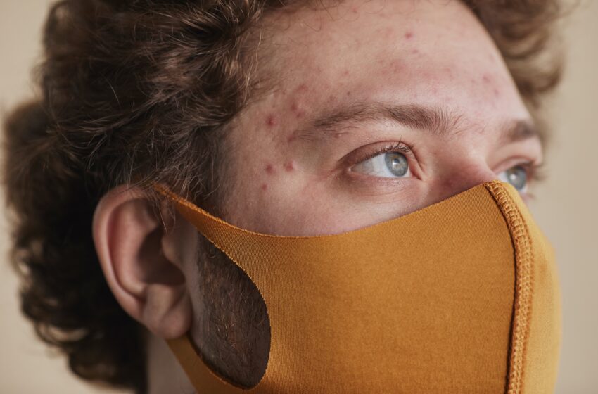  The Inside Story: Understanding Inflammation’s Role in Acne