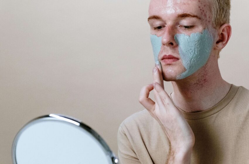 Acne and Masks